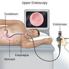 /التنظير العلوي (EGD) 