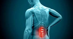 /LUMBAR LAMINECTOMY